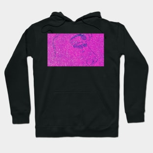 Glitter Moonwalker No. 1 Hoodie